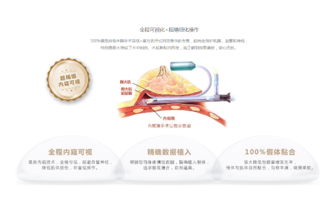 内窥镜隆胸