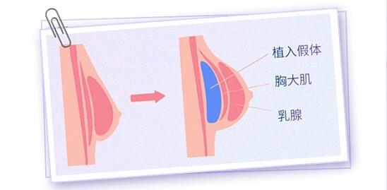 QQ截图20231208170420.jpg