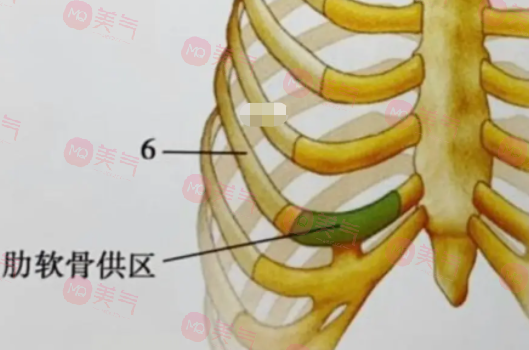 自体肋骨隆鼻的危害有哪些？手术风险、疼痛和肿胀…
