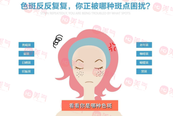 化学剥脱祛斑